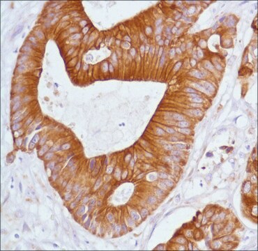 Anti-Keratin 20 antibody, Rabbit monoclonal clone SP33, recombinant, expressed in proprietary host, affinity isolated antibody