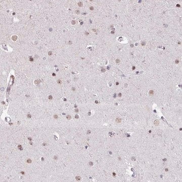 Anti-UTP18 antibody produced in rabbit Prestige Antibodies&#174; Powered by Atlas Antibodies, affinity isolated antibody, buffered aqueous glycerol solution