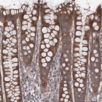 Anti-NAA25 antibody produced in rabbit Prestige Antibodies&#174; Powered by Atlas Antibodies, affinity isolated antibody, buffered aqueous glycerol solution