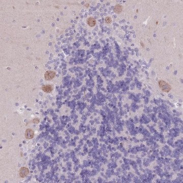 Anti-PIGM antibody produced in rabbit Prestige Antibodies&#174; Powered by Atlas Antibodies, affinity isolated antibody, buffered aqueous glycerol solution