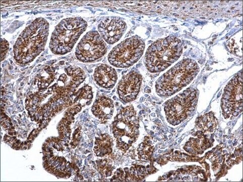 Anti-CS antibody produced in rabbit affinity isolated antibody, buffered aqueous solution