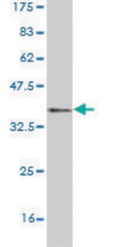 Monoclonal Anti-ACMSD antibody produced in mouse clone 3A9, purified immunoglobulin, buffered aqueous solution