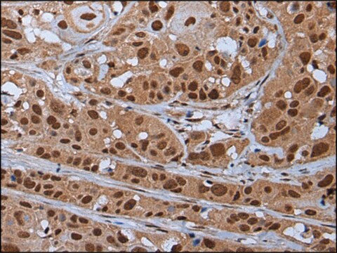 Anti-YY2 affinity isolated antibody