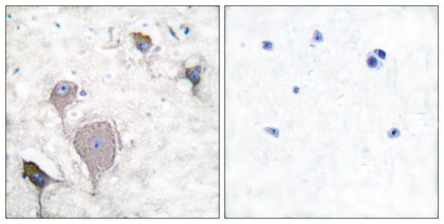 Anti-Peripherin antibody produced in rabbit affinity isolated antibody