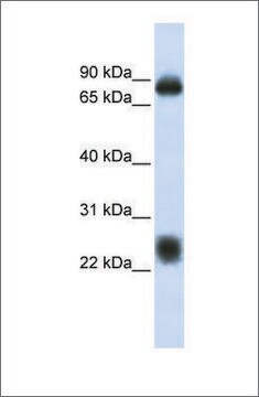 Anti-TSPAN8 antibody produced in rabbit affinity isolated antibody