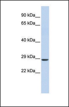 Anti-SIX2, (N-terminal) antibody produced in rabbit affinity isolated antibody