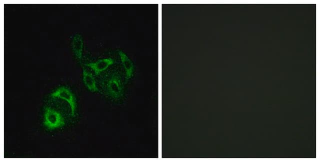 Anti-SLC27A4 antibody produced in rabbit affinity isolated antibody