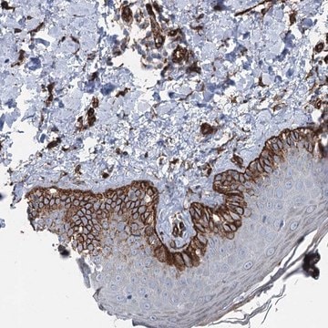 Anti-IQSEC1 antibody produced in rabbit Prestige Antibodies&#174; Powered by Atlas Antibodies, affinity isolated antibody, buffered aqueous glycerol solution