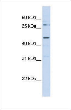 Anti-KREMEN1 antibody produced in rabbit affinity isolated antibody