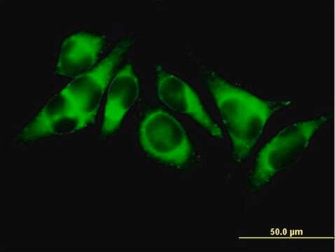 Anti-ACSL3 antibody produced in mouse purified immunoglobulin, buffered aqueous solution