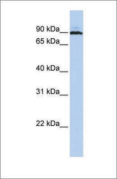 Anti-PEO1 (ab2) antibody produced in rabbit affinity isolated antibody