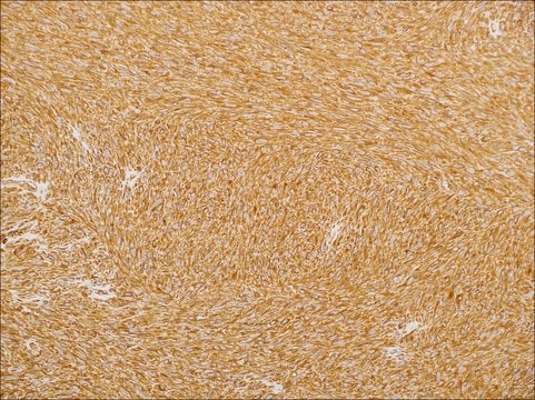 Vimentin (EP21) Rabbit Monoclonal Primary Antibody