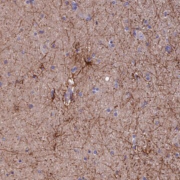 Anti-USP37 antibody produced in rabbit Prestige Antibodies&#174; Powered by Atlas Antibodies, affinity isolated antibody, buffered aqueous glycerol solution