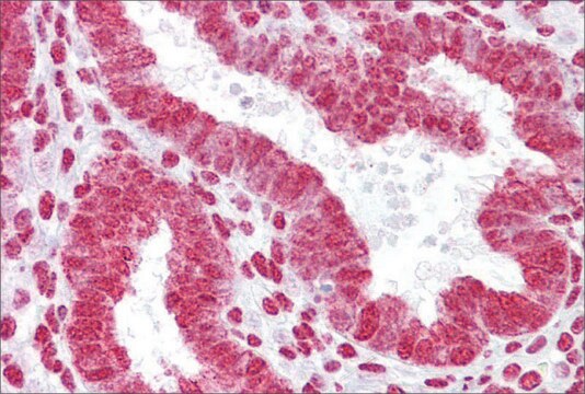 Anti-HOXA11 antibody produced in rabbit affinity isolated antibody