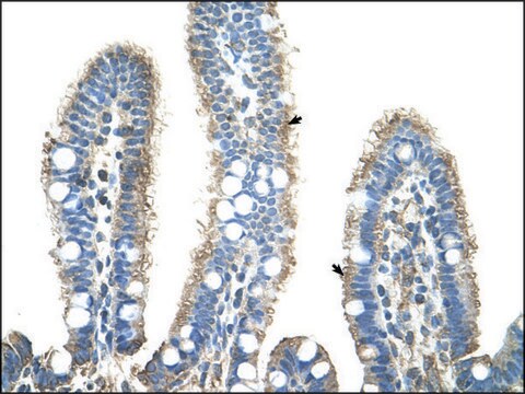 Anti-APCS antibody produced in rabbit IgG fraction of antiserum