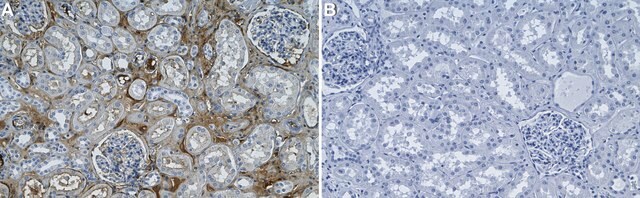 Anti-Complement C3 Antibody, clone 1D19 ZooMAb&#174; Rabbit Monoclonal recombinant, expressed in HEK 293 cells