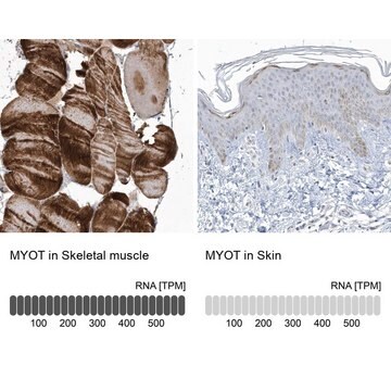 Anti-MYOT antibody produced in rabbit Prestige Antibodies&#174; Powered by Atlas Antibodies, affinity isolated antibody, buffered aqueous glycerol solution