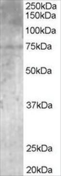 Anti-PALS/MPP5 antibody produced in goat affinity isolated antibody, buffered aqueous solution