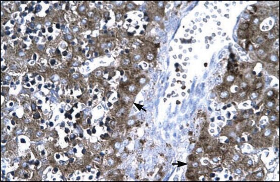 Anti-MMP19 (AB2) antibody produced in rabbit IgG fraction of antiserum