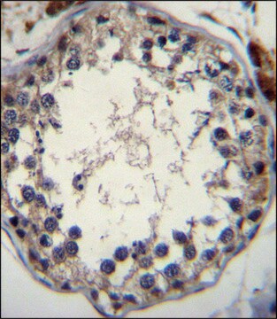 ANTI-STRA8 (C-TERM) antibody produced in rabbit IgG fraction of antiserum, buffered aqueous solution