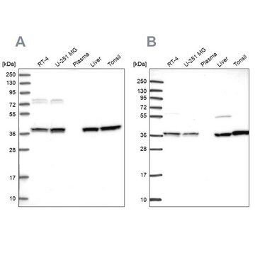 Anti-TALDO1 antibody produced in rabbit Prestige Antibodies&#174; Powered by Atlas Antibodies, affinity isolated antibody, buffered aqueous glycerol solution