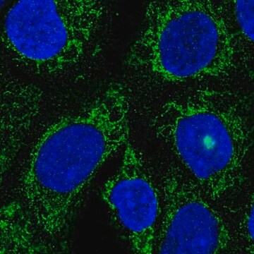 Anti-TMLHE antibody produced in rabbit Prestige Antibodies&#174; Powered by Atlas Antibodies, affinity isolated antibody