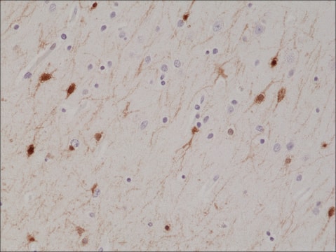 Anti-Calretinin (CALB2) antibody, Rabbit monoclonal recombinant, expressed in HEK 293 cells, clone RM324, purified immunoglobulin