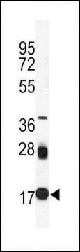 MONOCLONAL ANTI-UBC9 antibody produced in mouse clone 67AT1273.95.90, IgG fraction of antiserum, buffered aqueous solution