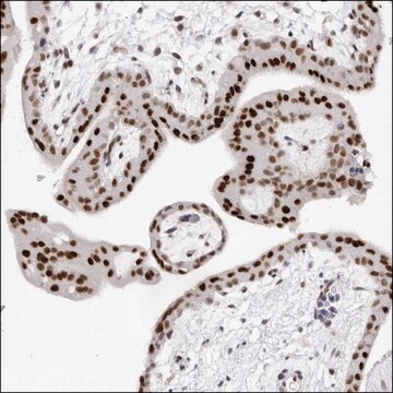 Anti-OGG1 antibody produced in rabbit Prestige Antibodies&#174; Powered by Atlas Antibodies, affinity isolated antibody, buffered aqueous glycerol solution