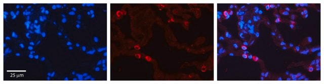 Anti-P4HB (AB2) antibody produced in rabbit affinity isolated antibody