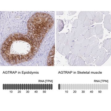 Anti-AGTRAP antibody produced in rabbit Prestige Antibodies&#174; Powered by Atlas Antibodies, affinity isolated antibody, buffered aqueous glycerol solution