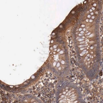 Anti-ARMCX4 antibody produced in rabbit Prestige Antibodies&#174; Powered by Atlas Antibodies, affinity isolated antibody, buffered aqueous glycerol solution