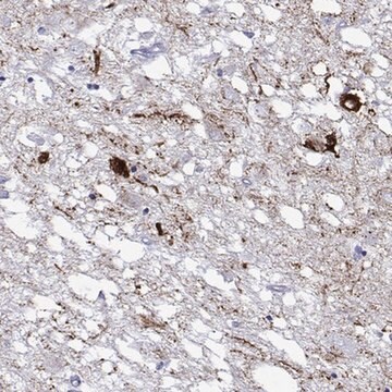 Anti-HTR7 antibody produced in rabbit Prestige Antibodies&#174; Powered by Atlas Antibodies, affinity isolated antibody