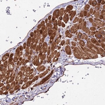 Anti-ESCO1 antibody produced in rabbit Prestige Antibodies&#174; Powered by Atlas Antibodies, affinity isolated antibody, buffered aqueous glycerol solution