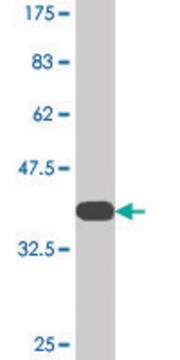 Monoclonal Anti-PFKFB3, (C-terminal) antibody produced in mouse clone 3F3, purified immunoglobulin, buffered aqueous solution