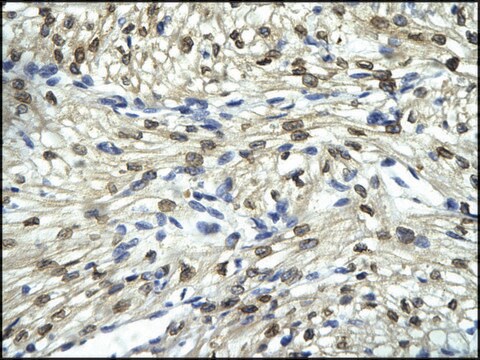 Anti-FLI1 antibody produced in rabbit affinity isolated antibody