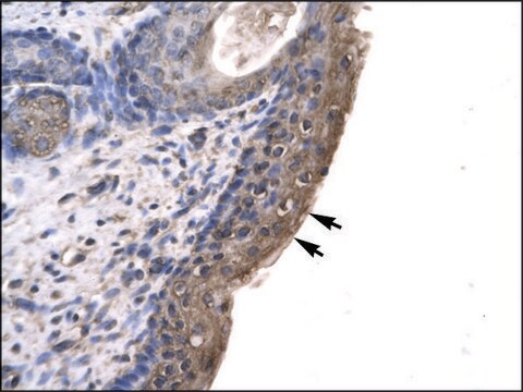 Anti-RNF12 antibody produced in rabbit affinity isolated antibody