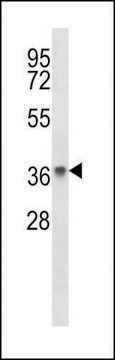 ANTI-PAQR8 (C-TERM) antibody produced in rabbit IgG fraction of antiserum, buffered aqueous solution