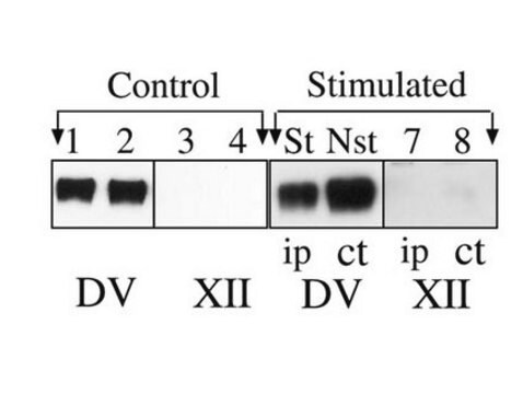 Anticorps anti-acide polysialique-NCAM, clone&nbsp;2-2B ascites fluid, clone 2-2B, Chemicon&#174;