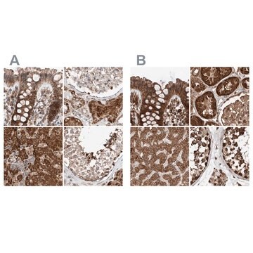 Anti-ZSCAN29 antibody produced in rabbit Prestige Antibodies&#174; Powered by Atlas Antibodies, affinity isolated antibody, buffered aqueous glycerol solution, ab2