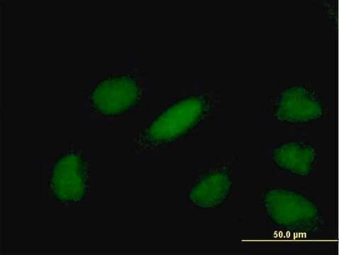 Anti-YEATS4 antibody produced in mouse purified immunoglobulin, buffered aqueous solution