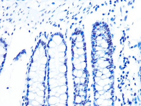 Anti-U2AF2/U2AF65 Antibody, clone 8E8R9, Rabbit Monoclonal