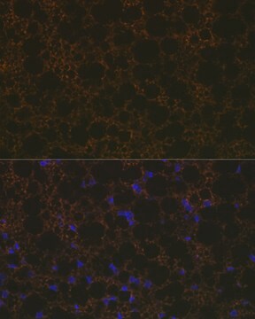 Anti-UCP1+UCP3 Antibody, clone 0S10O10, Rabbit Monoclonal