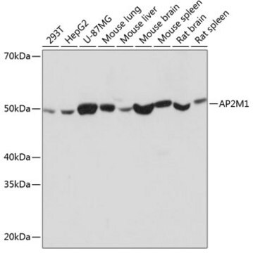 Anti-AP2M1 Antibody, clone 10J8D1, Rabbit Monoclonal