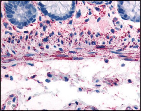 Anti-ADRA1B (AB2) antibody produced in rabbit affinity isolated antibody, buffered aqueous solution