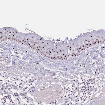 抗PAX3抗体 ウサギ宿主抗体 Prestige Antibodies&#174; Powered by Atlas Antibodies, affinity isolated antibody, buffered aqueous glycerol solution