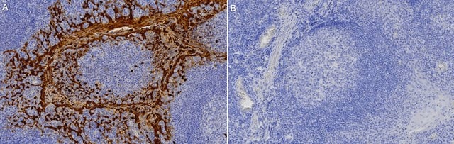 Anti-S100-A9/MRP14 Antibody, clone 1M6 ZooMAb&#174; Rabbit Monoclonal recombinant, expressed in HEK 293 cells