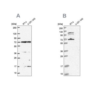 Anti-ARAF antibody produced in rabbit Prestige Antibodies&#174; Powered by Atlas Antibodies, affinity isolated antibody, buffered aqueous glycerol solution