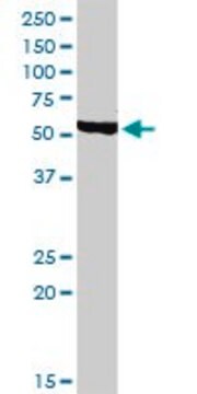 Anti-CHRDL1 antibody produced in rabbit purified immunoglobulin, buffered aqueous solution