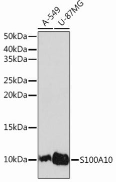 Anti-S100A10 Antibody, clone 6X8F7, Rabbit Monoclonal